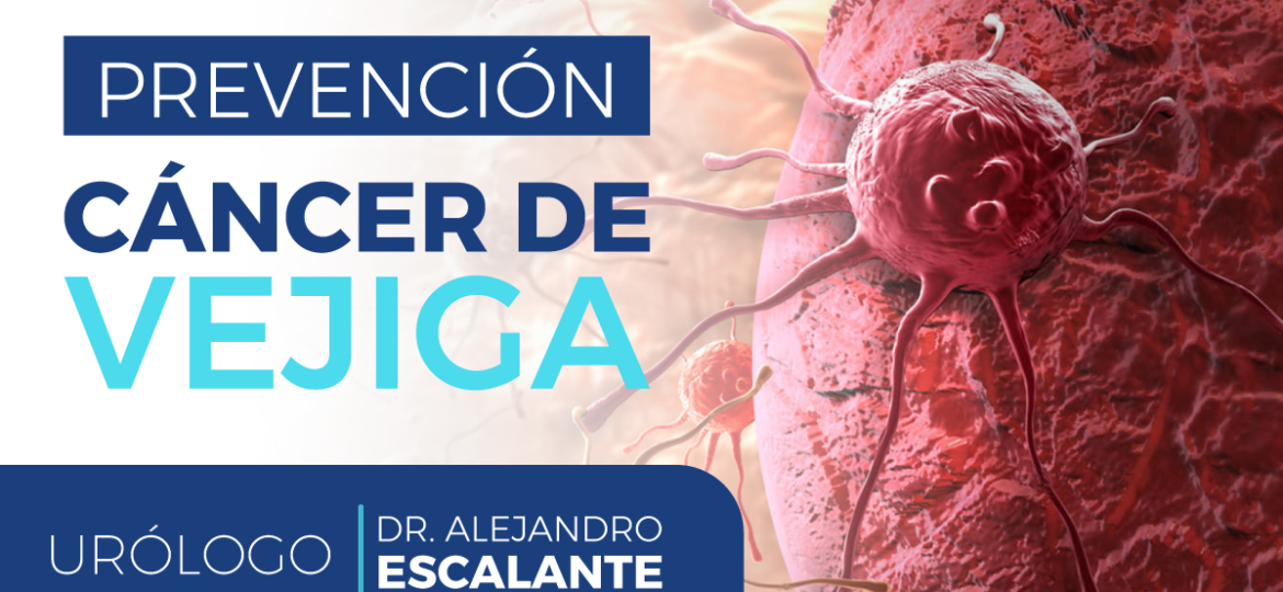 prevención_cancer_de_vejiga_dr_escalante_urologo