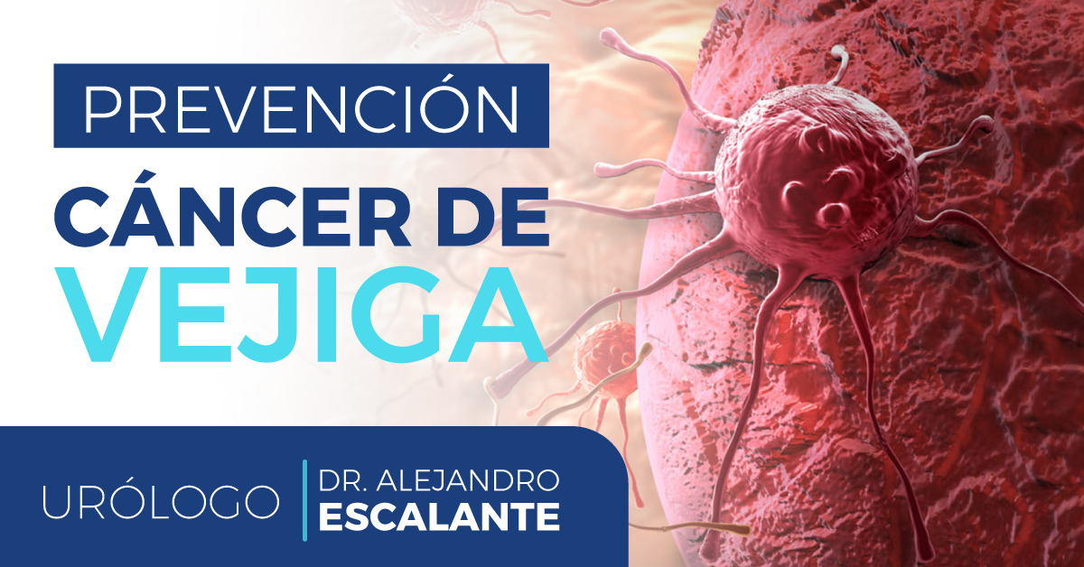 prevención_cancer_de_vejiga_dr_escalante_urologo